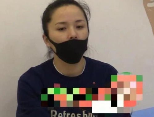 罕见病现身，女子皮肤如橡皮人，可自由拉伸