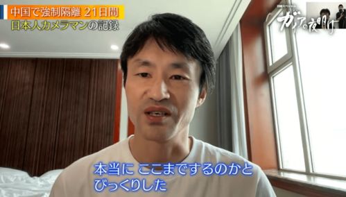 日本小哥凭“世界最长下巴”走红